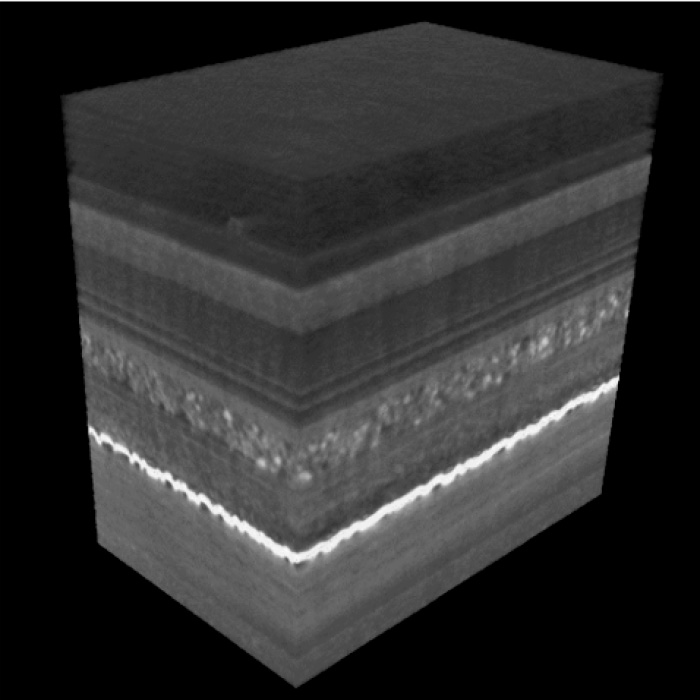 Hochauflösende Röntgentomographie der inneren Batteriestruktur